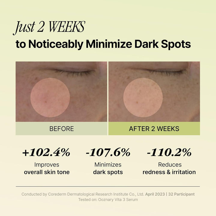 Vitamin C Brightening &amp; Tone Repair Serum