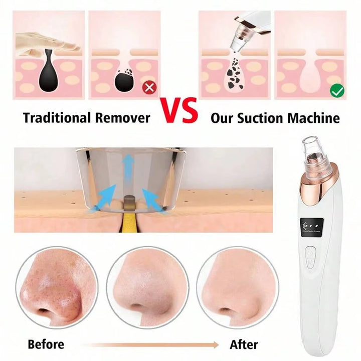 Electric Pore Cleaner &amp; Blackhead Remover